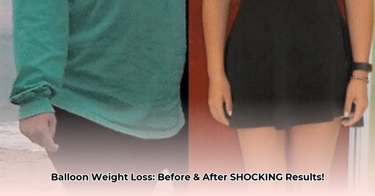 balloon-weight-loss-before-and-after